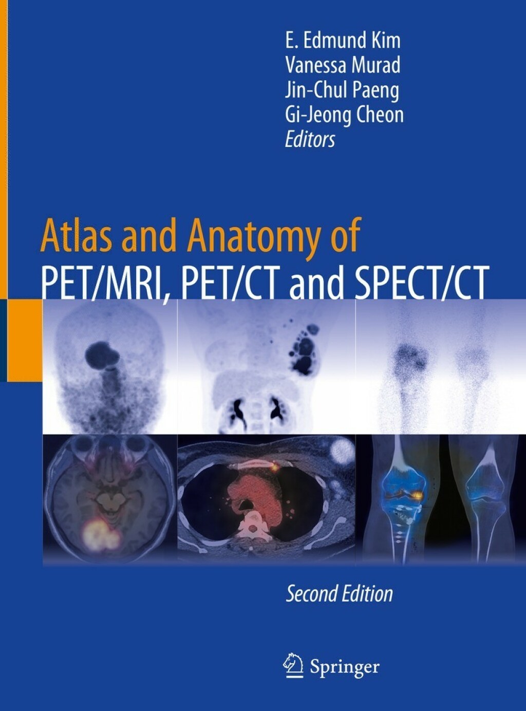 Atlas and Anatomy of PET/MRI, PET/CT and SPECT/CT 2nd Edition