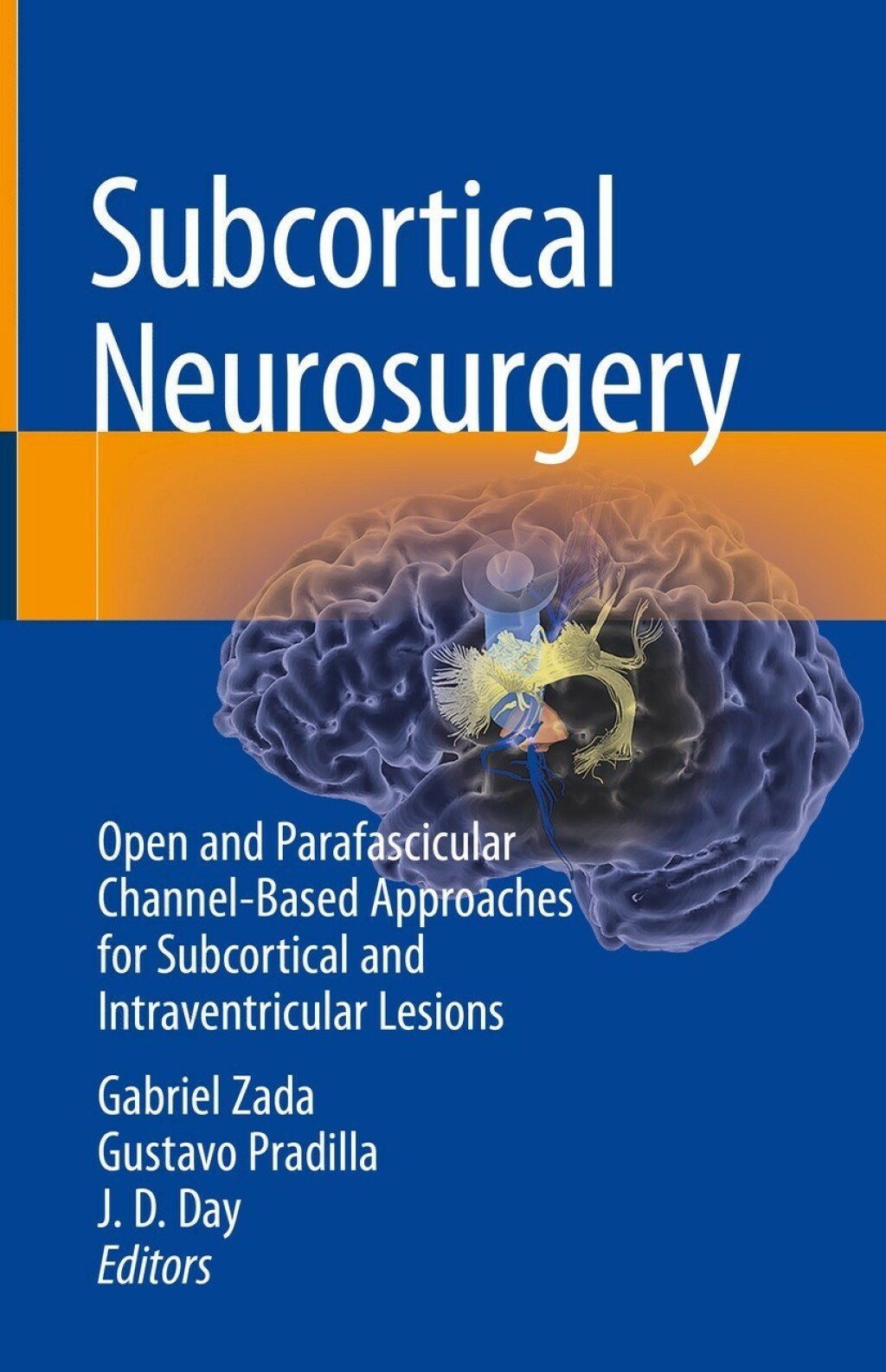 Subcortical Neurosurgery Open and Parafascicular Channel-Based Approaches for Subcortical and Intraventricular Lesions 