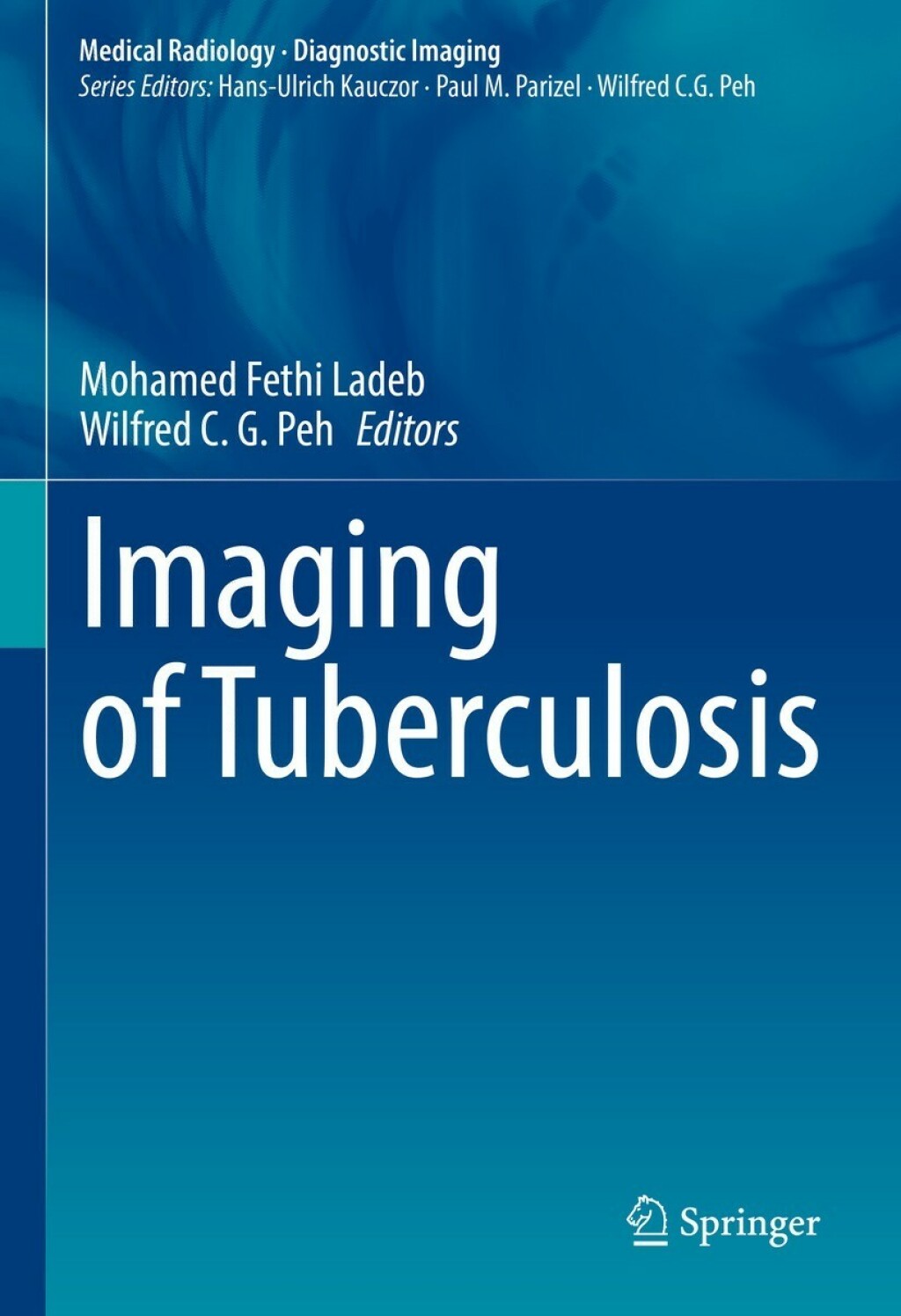 Imaging of Tuberculosis 