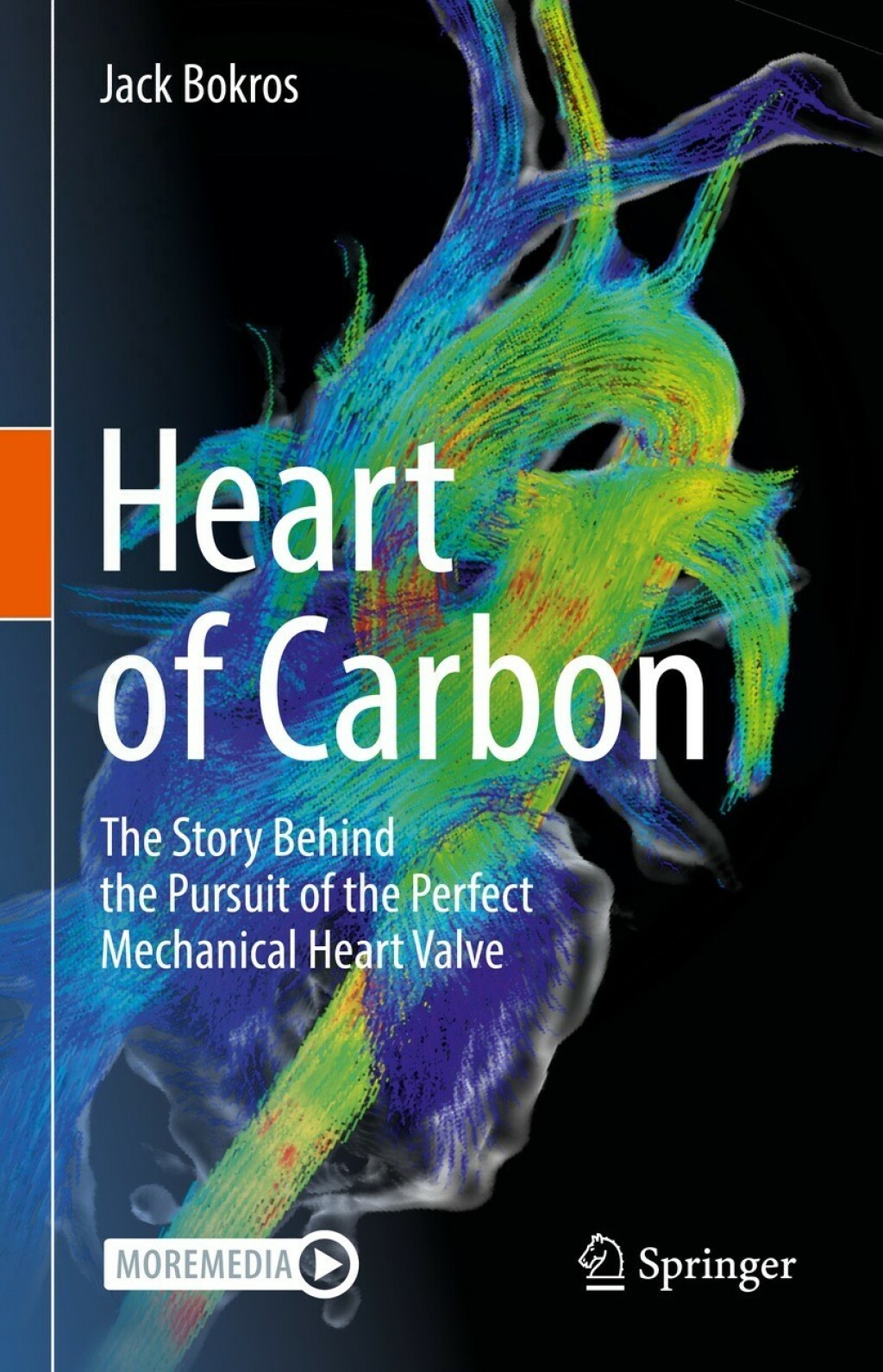 Heart of Carbon The Story Behind the Pursuit of the Perfect Mechanical Heart Valve 