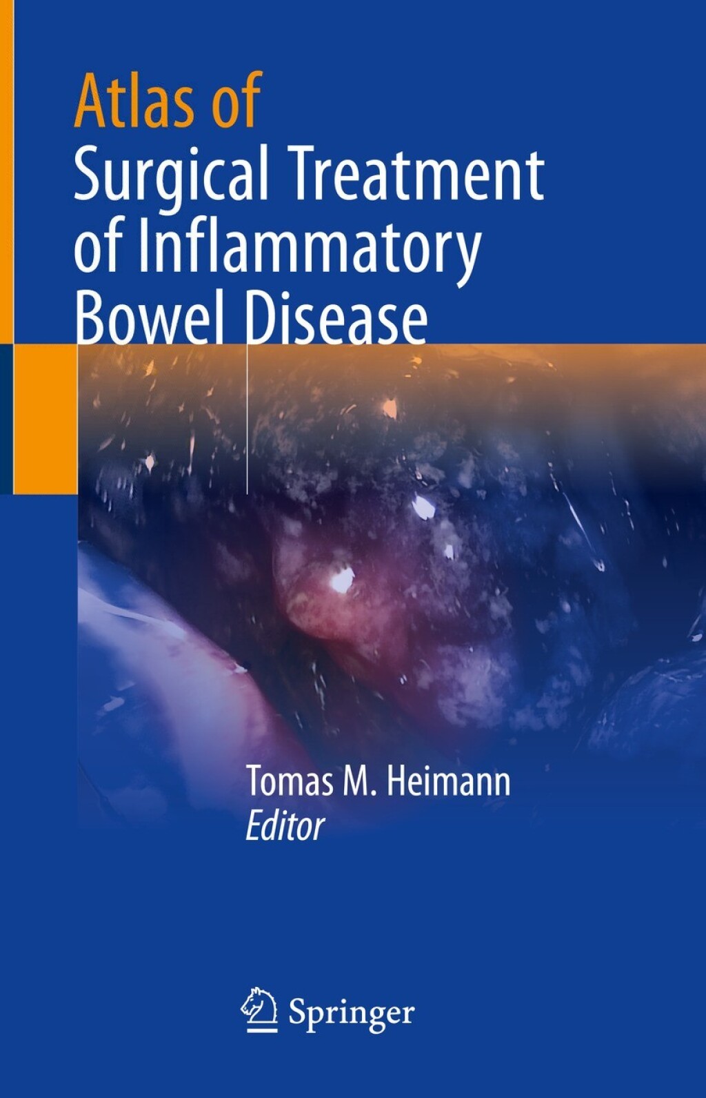 Atlas of Surgical Treatment of Inflammatory Bowel Disease 