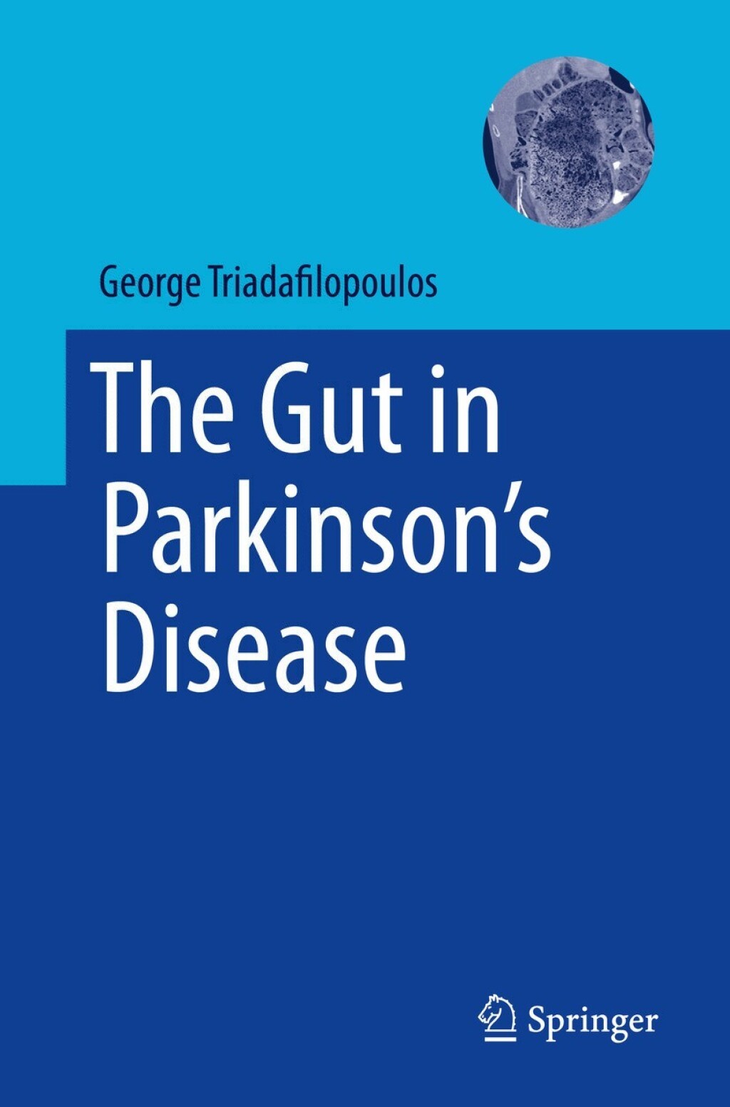 The Gut in Parkinson's Disease 