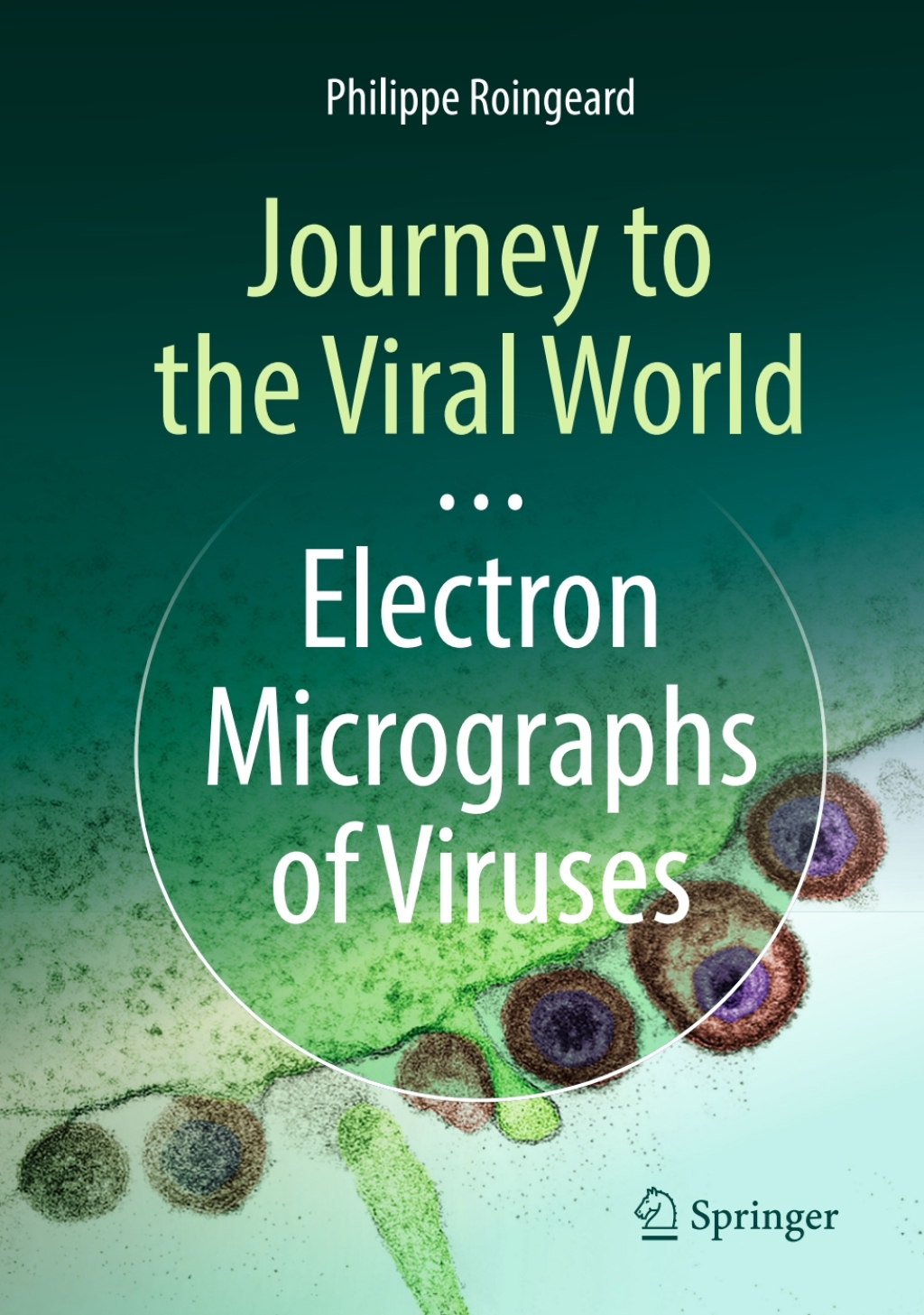 Journey to the Viral World: Electron Micrographs of Viruses 