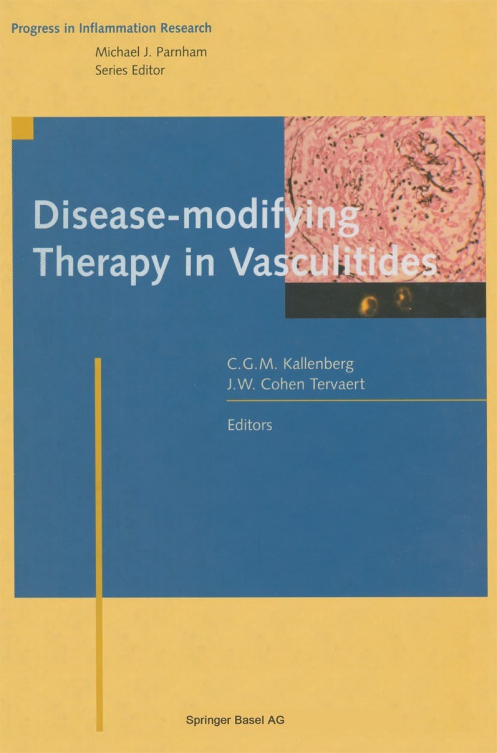 Disease-modifying Therapy in Vasculitides 1st Edition