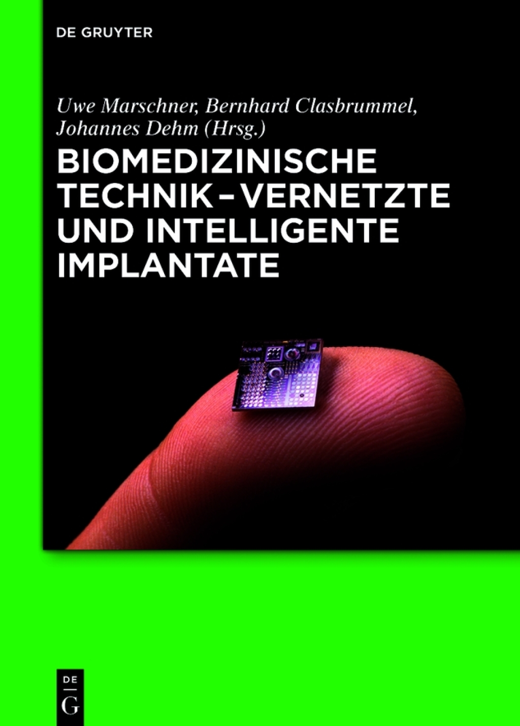 Biomedizinische Technik - Vernetzte und intelligente Implantate 1st Edition