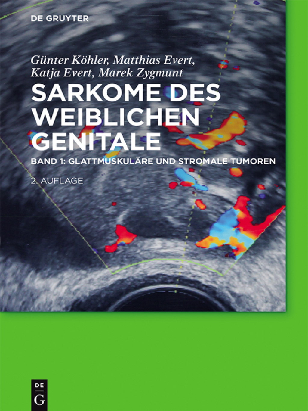 GlattmuskulÃƒÂ¤re und stromale Tumoren 2nd Edition