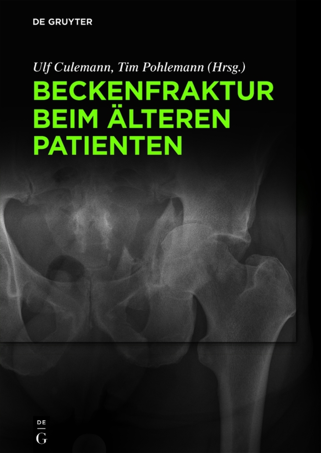 Beckenfraktur beim ÃƒÂ¤lteren Patienten 1st Edition