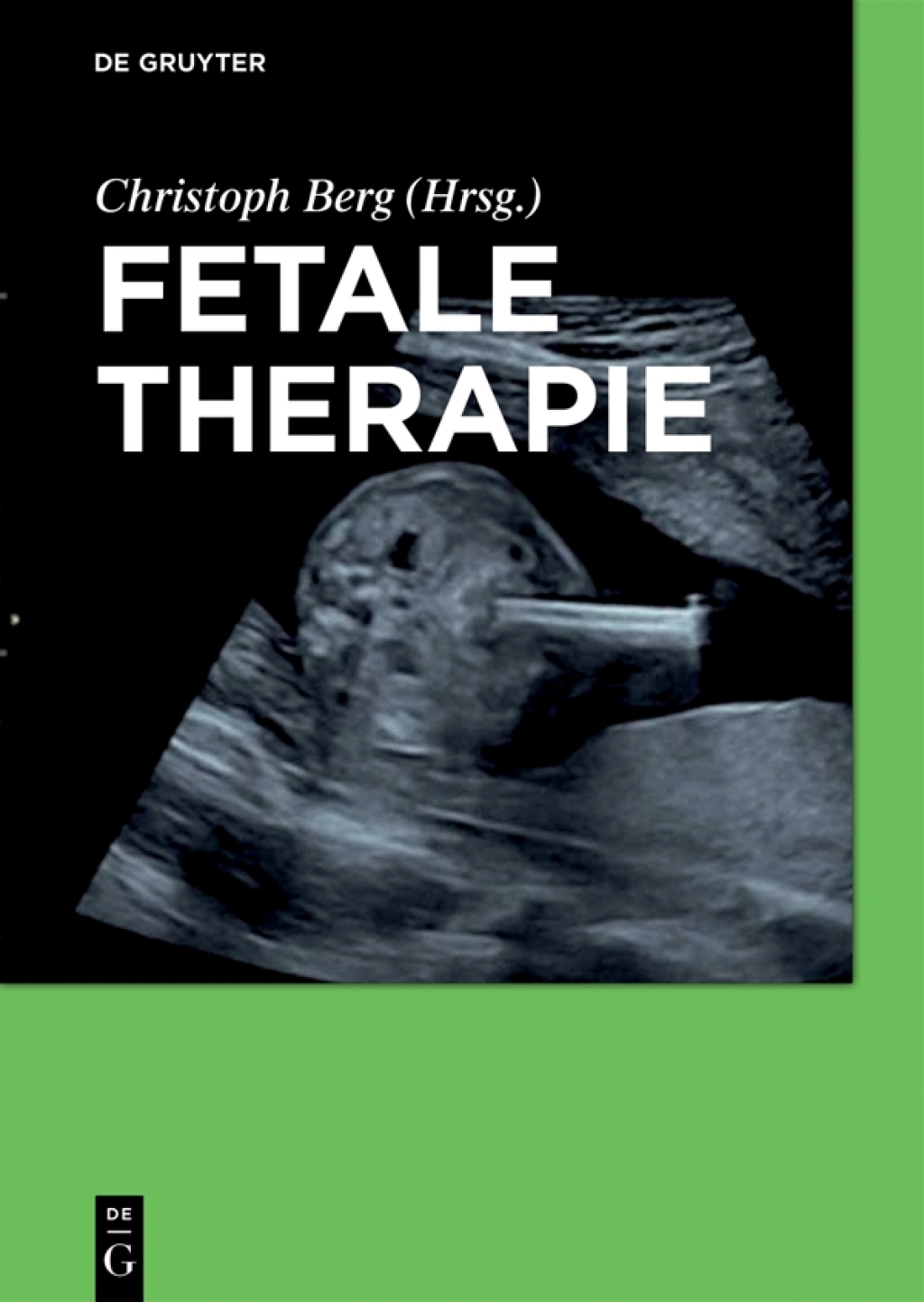 Fetale Therapie 1st Edition