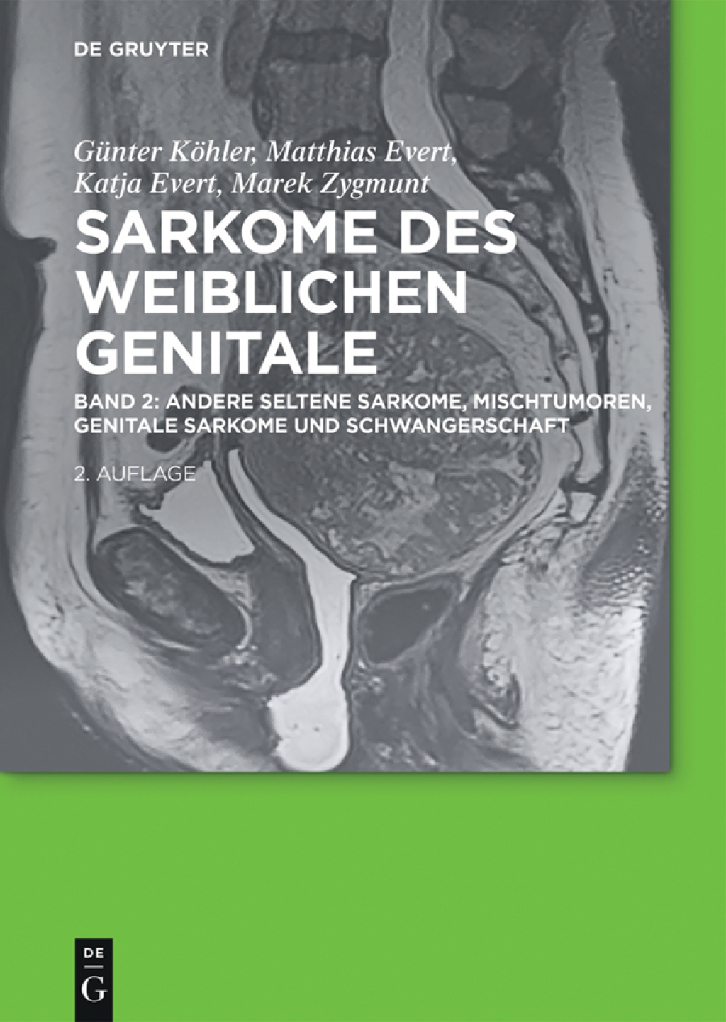 Andere seltene Sarkome, Mischtumoren, genitale Sarkome und Schwangerschaft 1st Edition
