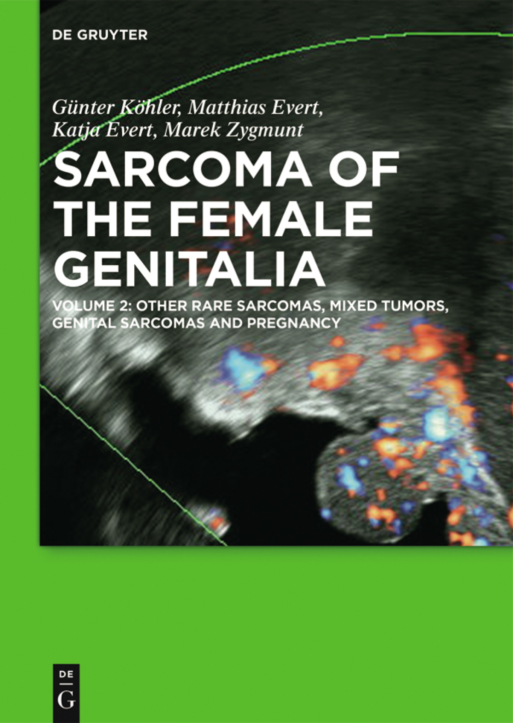 Other Rare Sarcomas, Mixed Tumors, Genital Sarcomas and Pregnancy 1st Edition