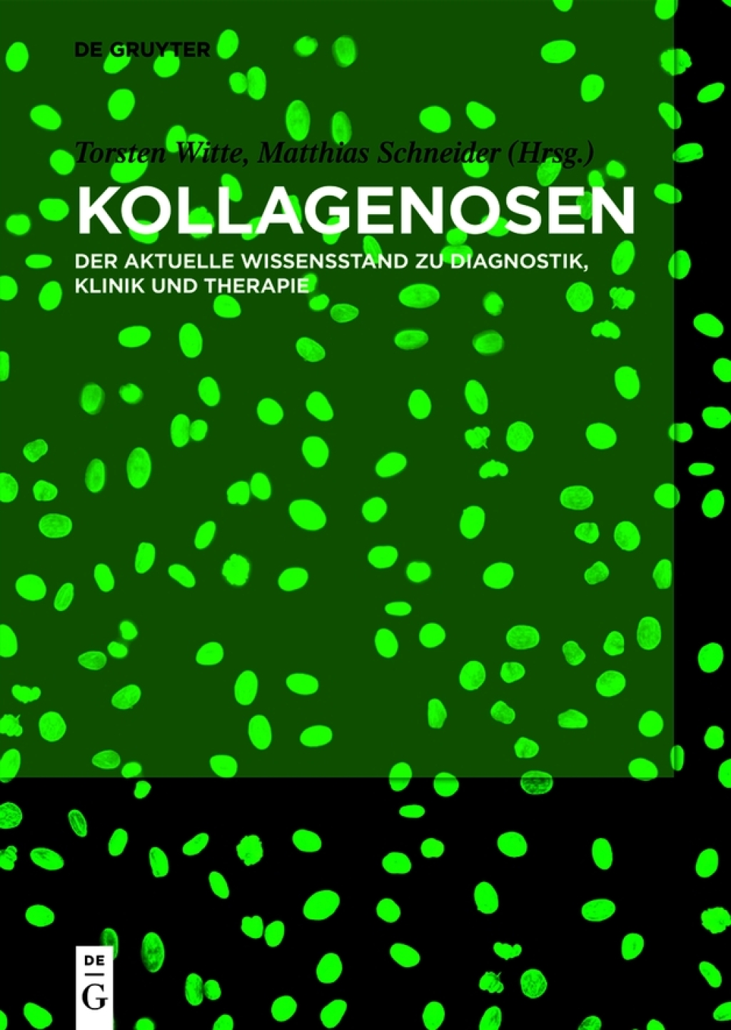 Kollagenosen Der aktuelle Wissensstand zu Diagnostik, Klinik und Therapie 1st Edition