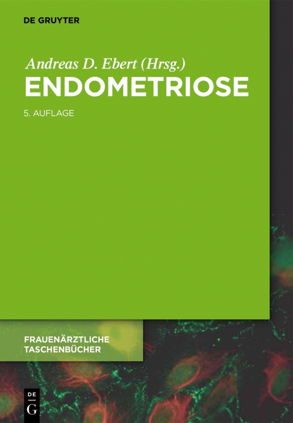 Endometriose Ein Wegweiser fÃƒÂ¼r die Praxis 5th Edition