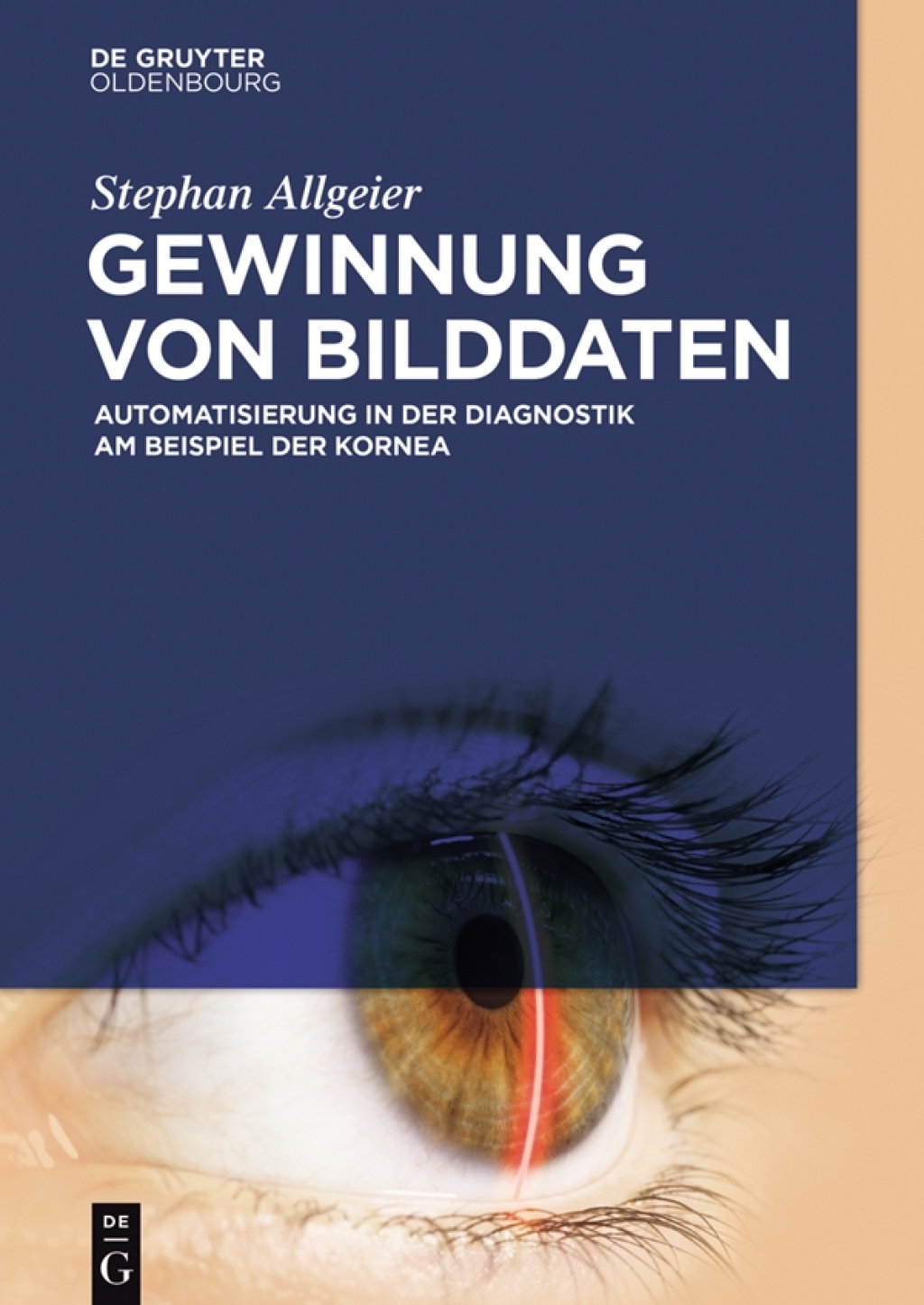Gewinnung von Bilddaten Automatisierung in der Diagnostik am Beispiel der Kornea 1st Edition
