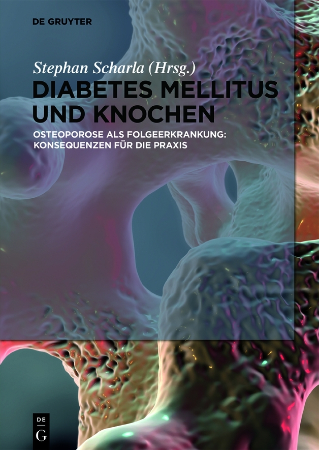 Diabetes Mellitus und Knochen Osteoporose als Folgeerkrankung: Konsequenzen fÃƒÂ¼r die Praxis 1st Edition