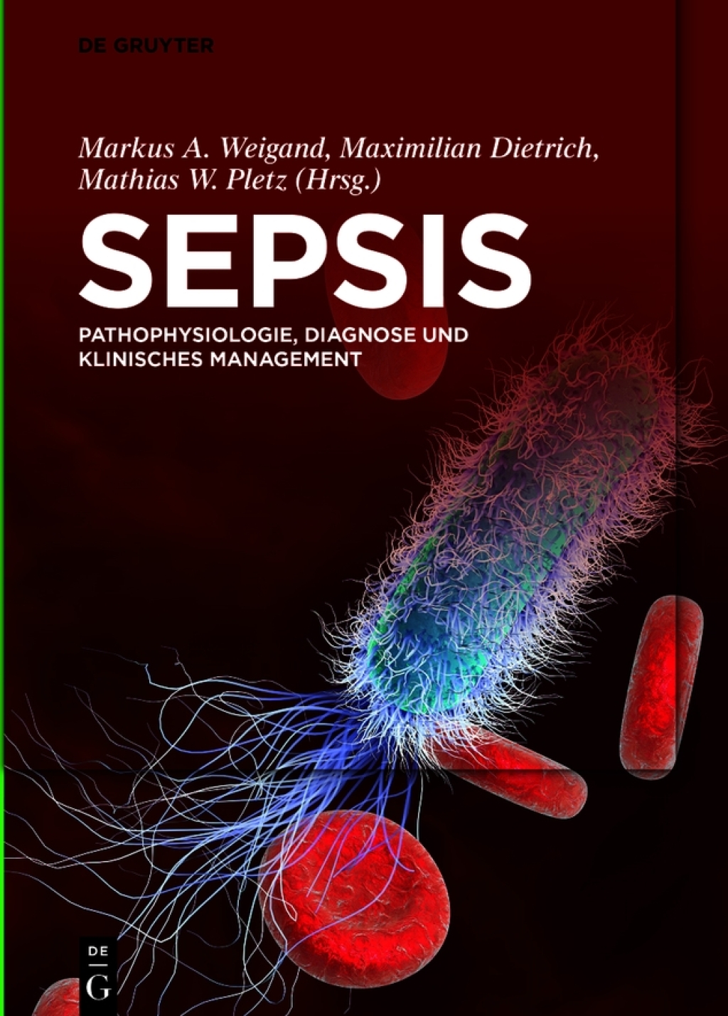 Sepsis Pathophysiologie, Diagnose und klinisches Management 1st Edition