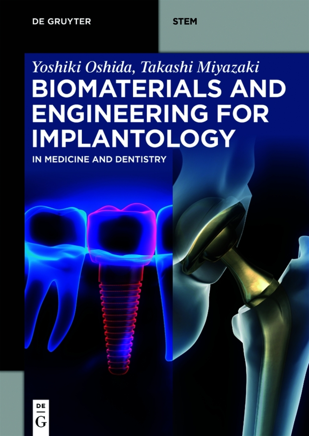 Biomaterials and Engineering for Implantology In Medicine and Dentistry 1st Edition