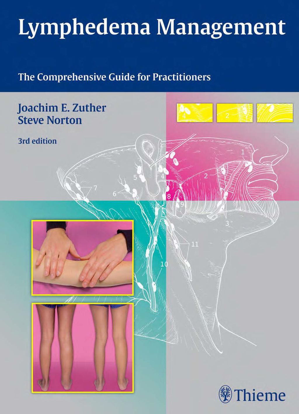 Lymphedema Management The Comprehensive Guide for Practitioners 3rd Edition