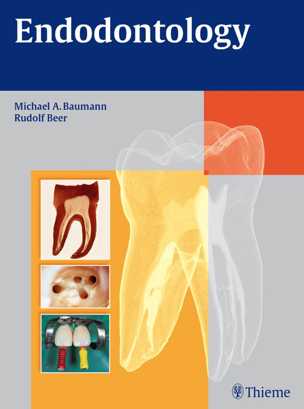 Endodontology 2nd Edition