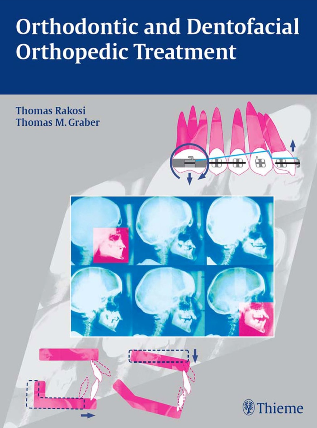 Orthodontic and Dentofacial Orthopedic Treatment 1st Edition