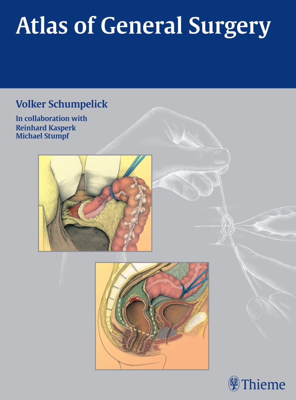 Atlas of General Surgery 1st Edition