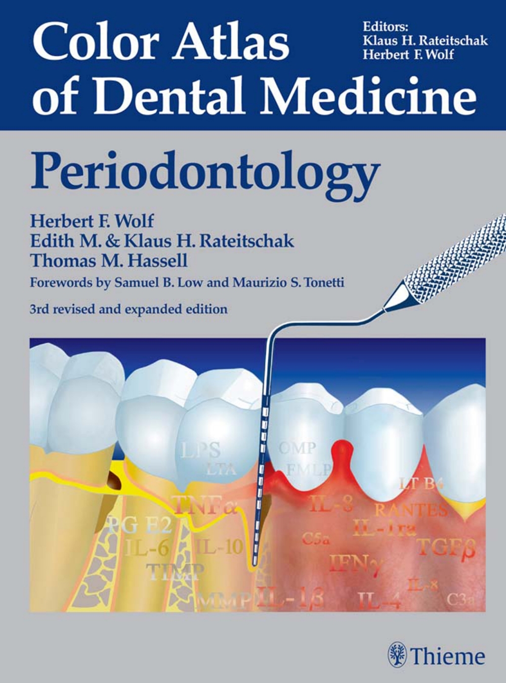 Color Atlas of Dental Medicine: Periodontology Periodontology 3rd Edition