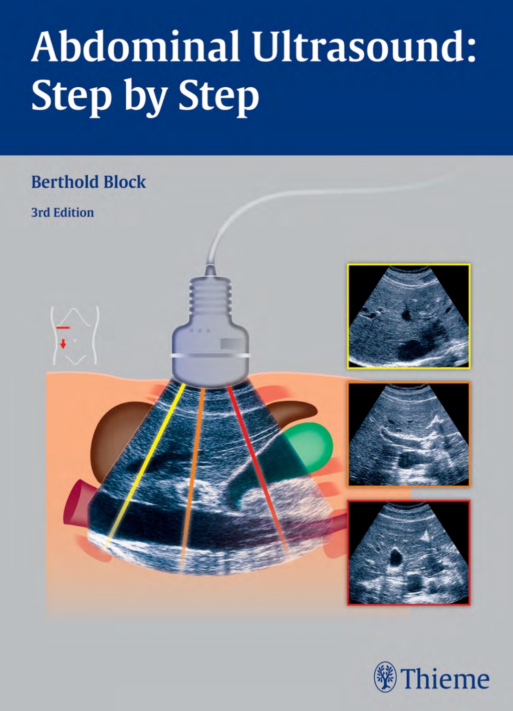 Abdominal Ultrasound: Step by Step 3rd Edition