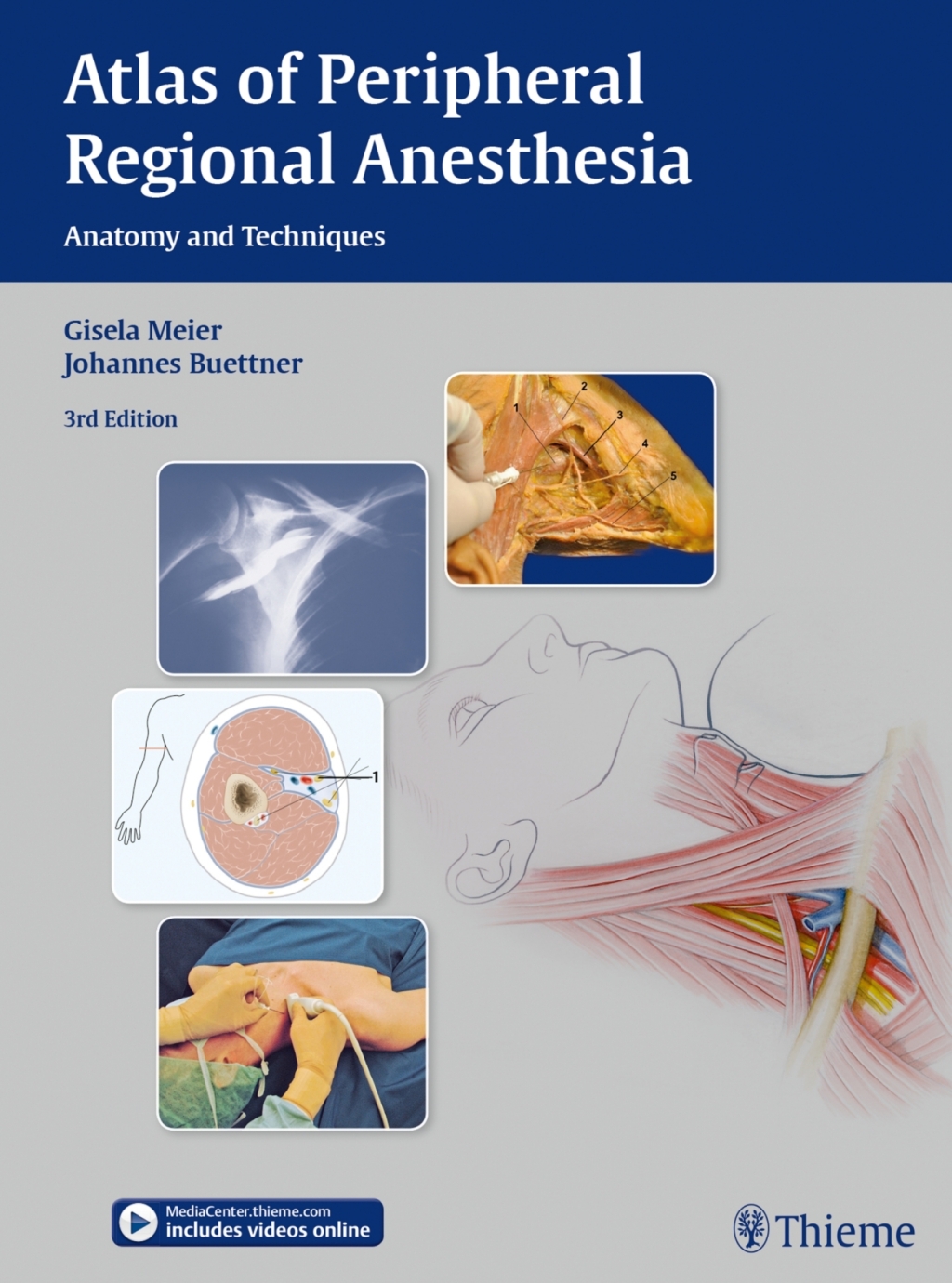 Atlas of Peripheral Regional Anesthesia Anatomy and Techniques 3rd Edition