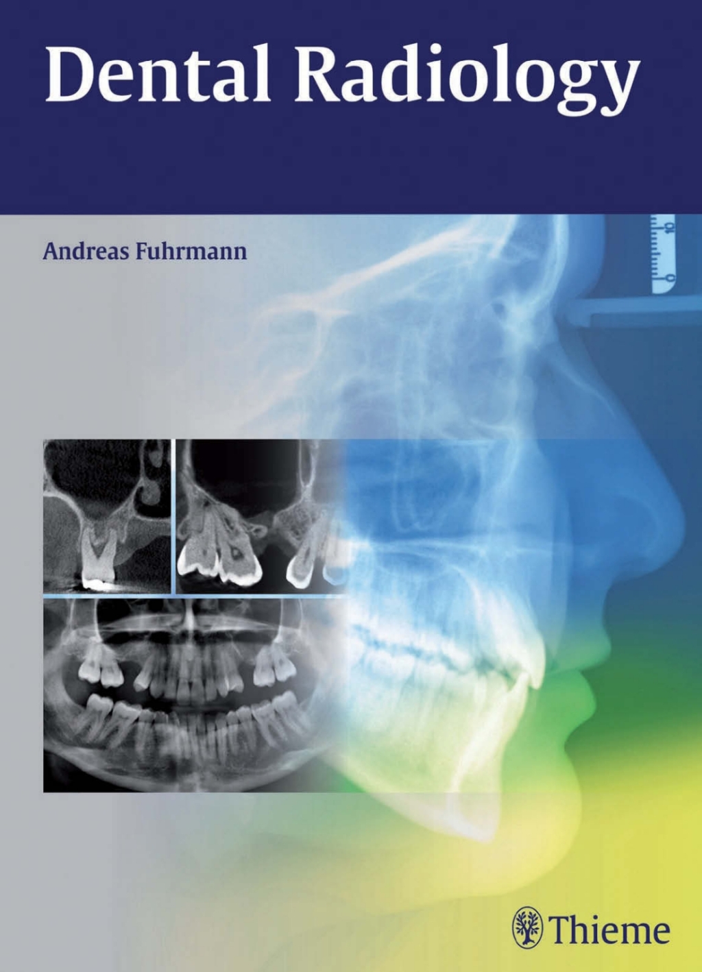 Dental Radiology 1st Edition