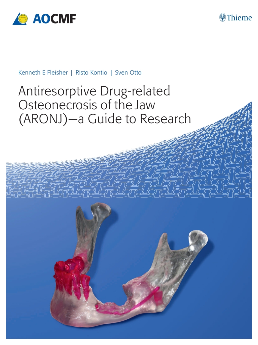 Antiresorptive Drug-Related Osteonecrosis of the Jaw (ARONJ) - A Guide to Research 1st Edition