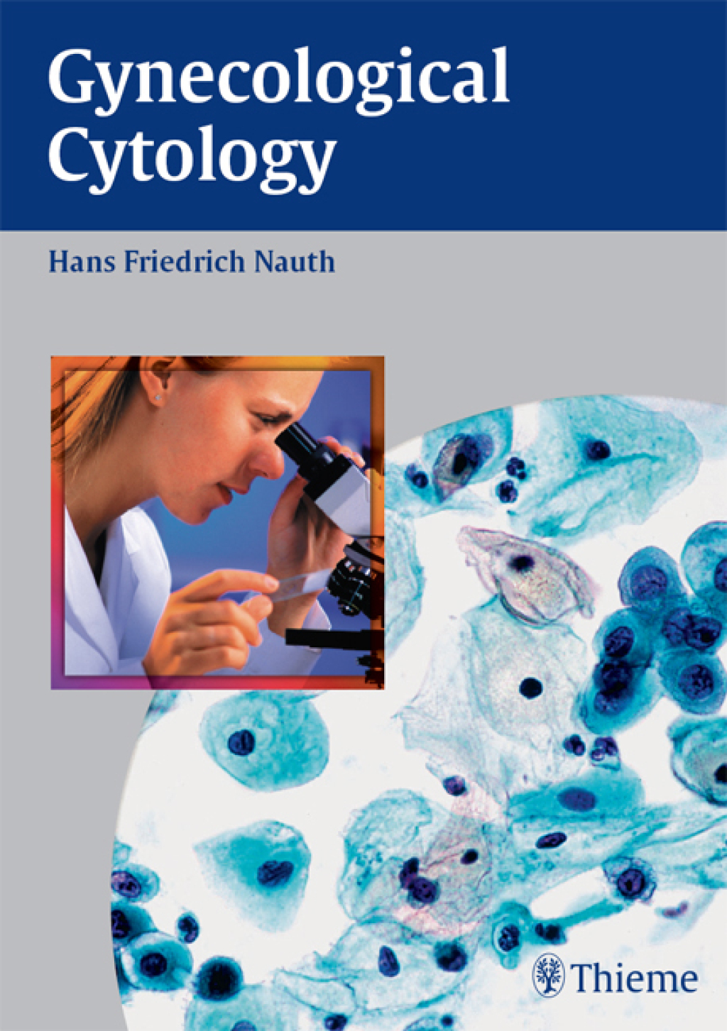Gynecological Cytology 1st Edition