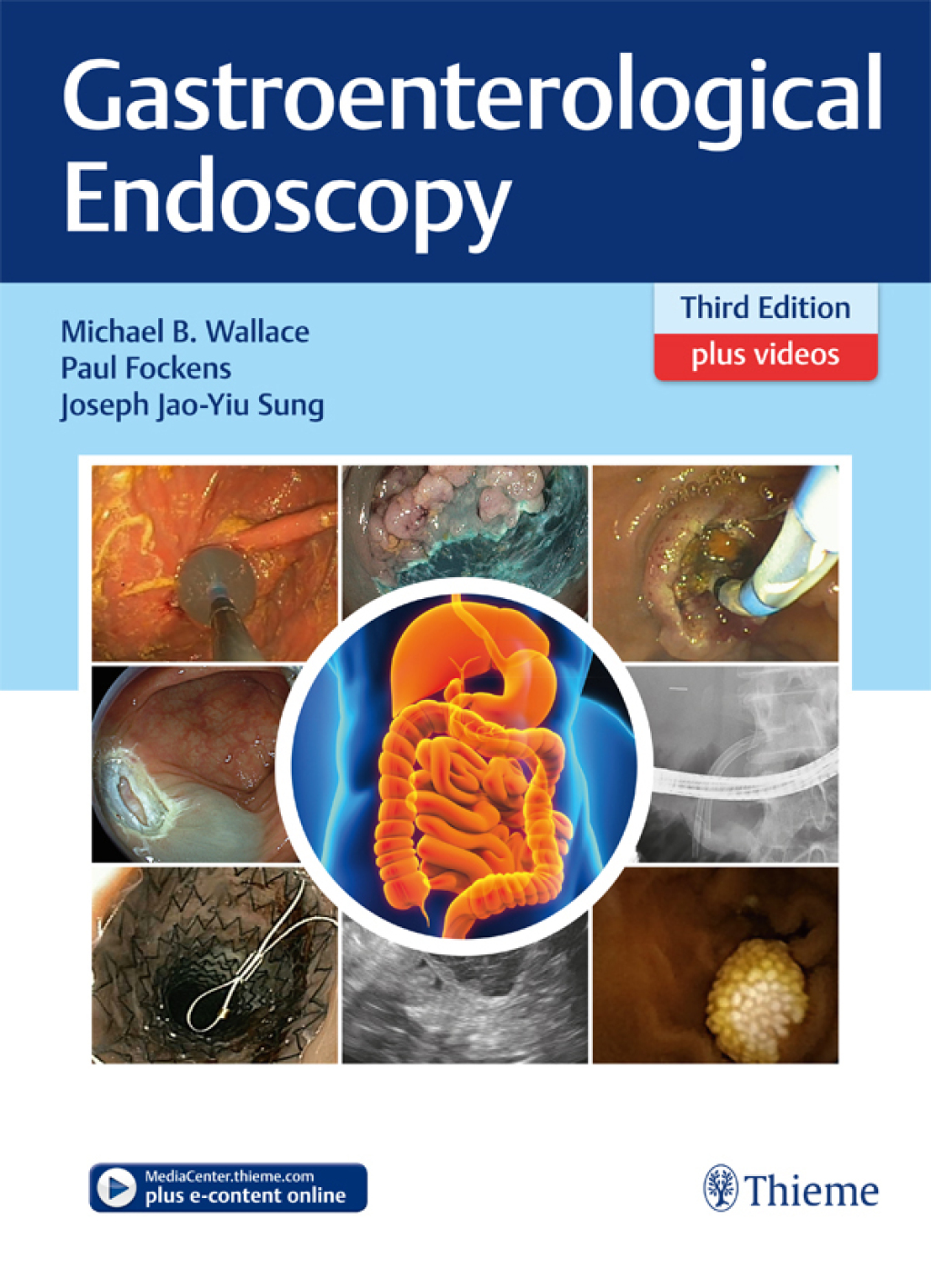 Gastroenterological Endoscopy 3rd Edition