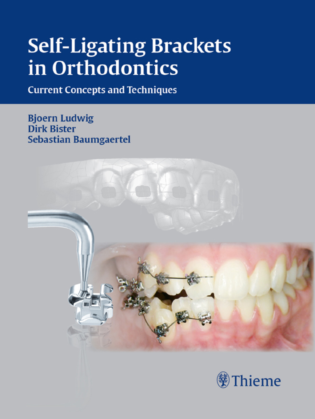 Self-Ligating Brackets in Orthodontics Current Concepts and Techniques 1st Edition