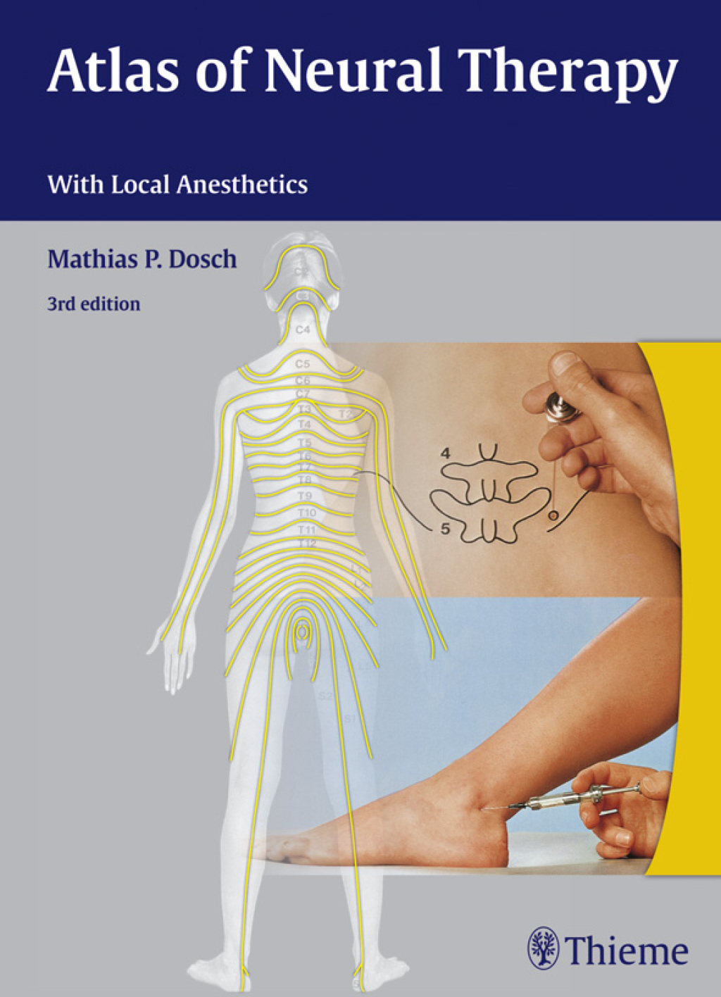 Atlas of Neural Therapy With Local Anesthetics 3rd Edition