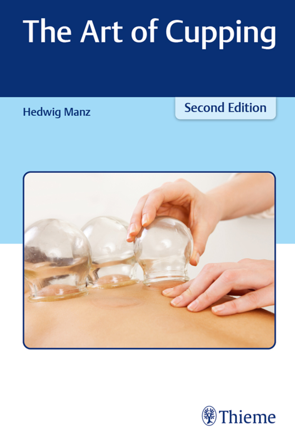 The Art of Cupping 2nd Edition