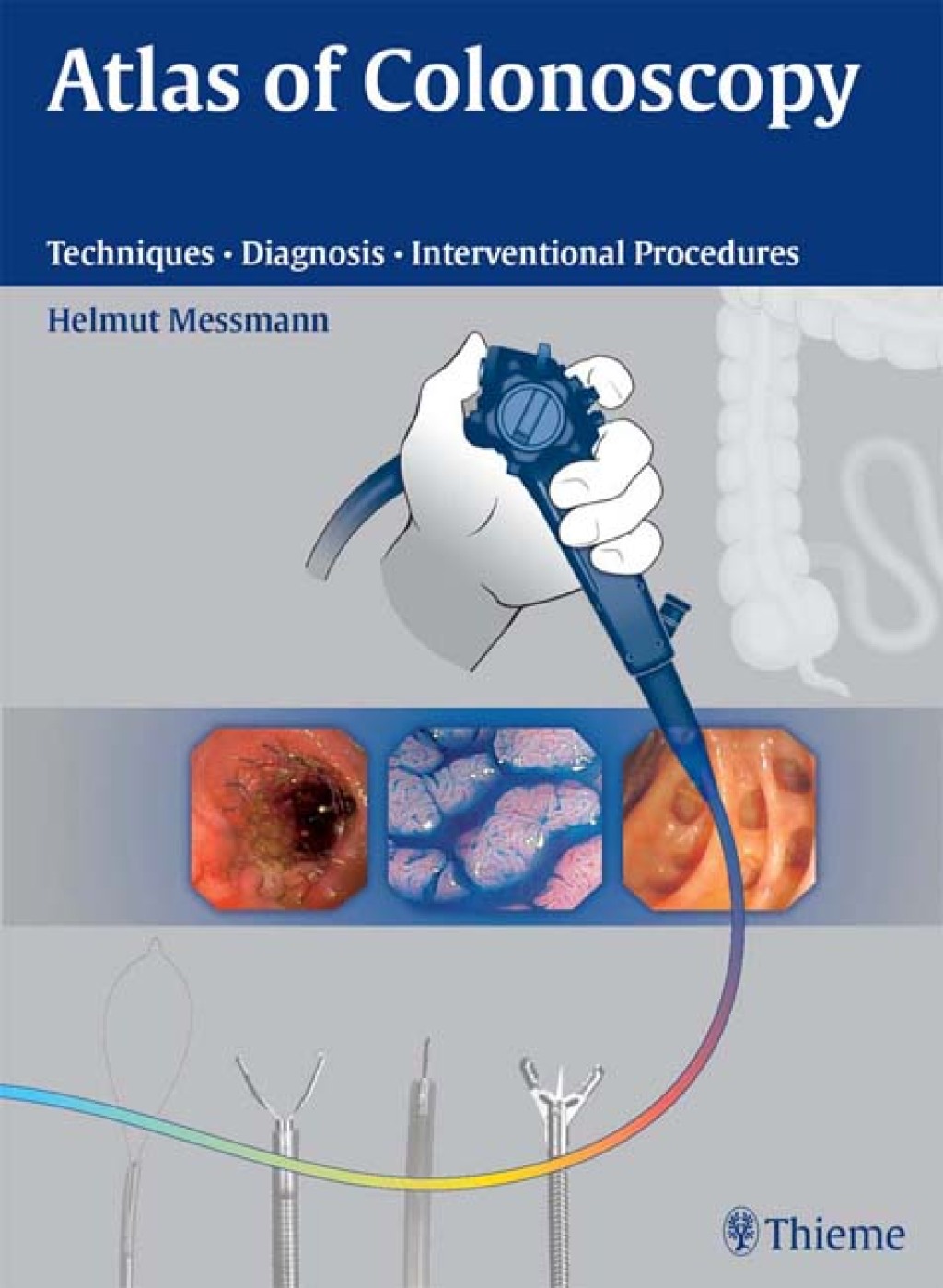Atlas of Colonoscopy Techniques - Diagnosis - Interventional Procedures 1st Edition