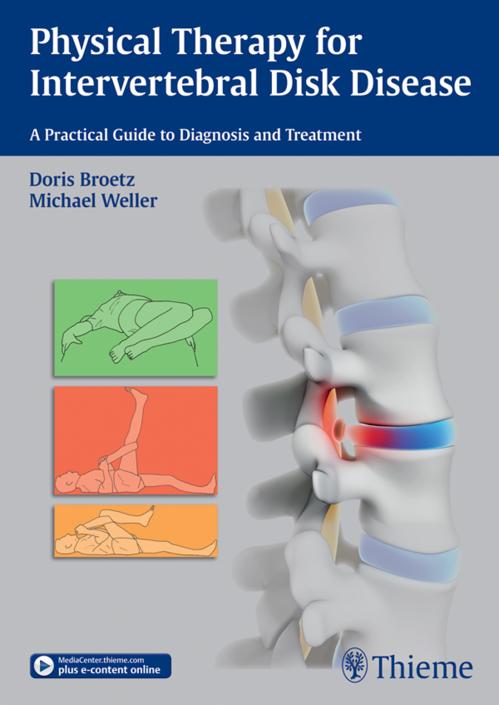 Physical Therapy for Intervertebral Disk Disease A Practical Guide to Diagnosis and Treatment 1st Edition