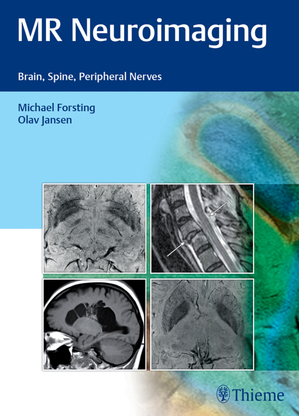 MR Neuroimaging Brain, Spine, Peripheral Nerves 1st Edition
