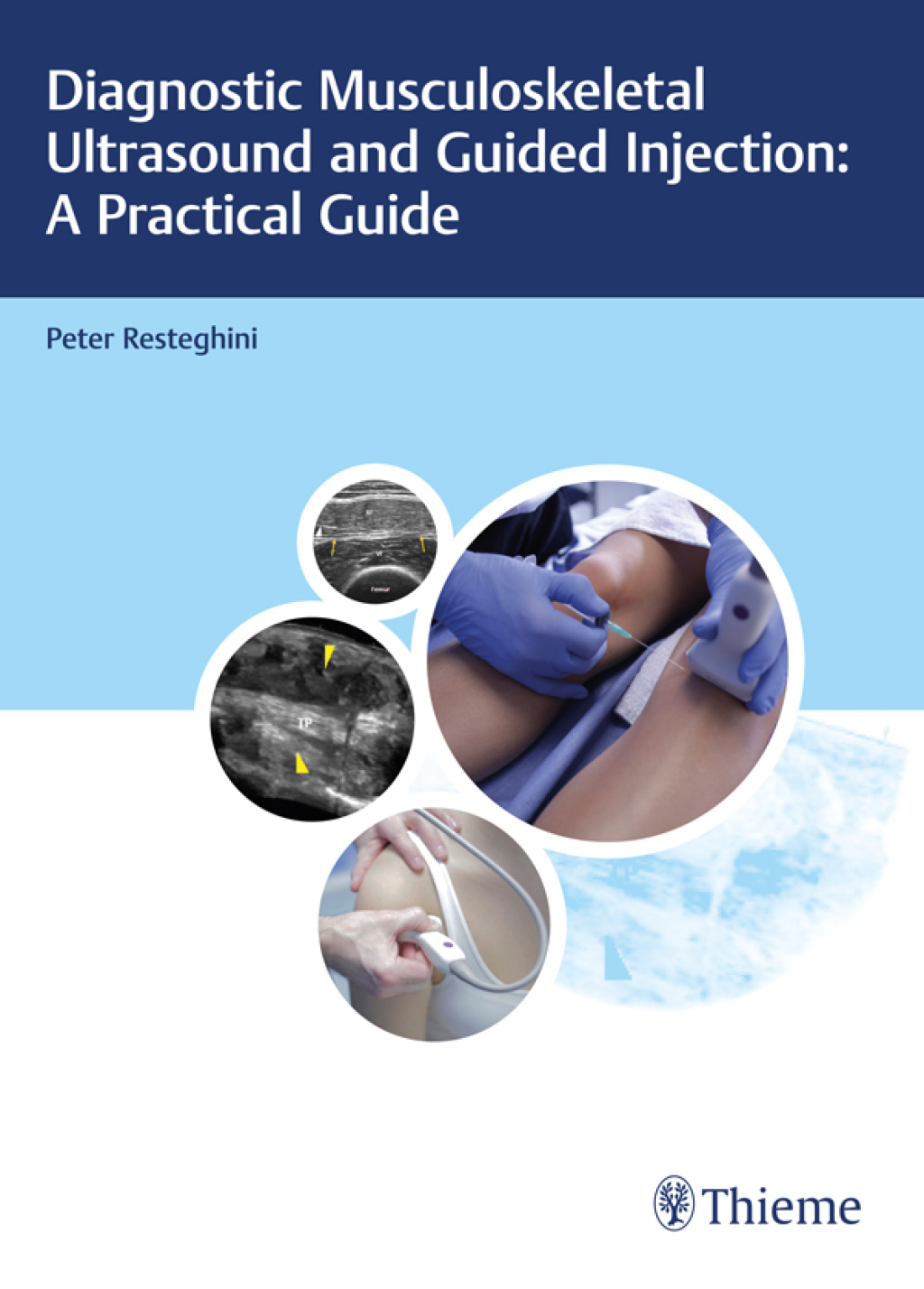 Diagnostic Musculoskeletal Ultrasound and Guided Injection: A Practical Guide 1st Edition