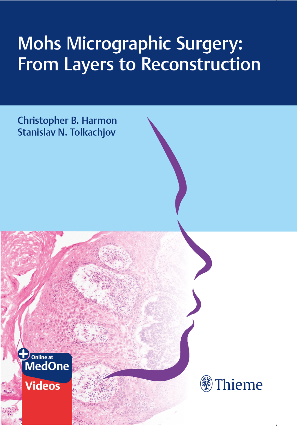 Mohs Micrographic Surgery: From Layers to Reconstruction 1st Edition
