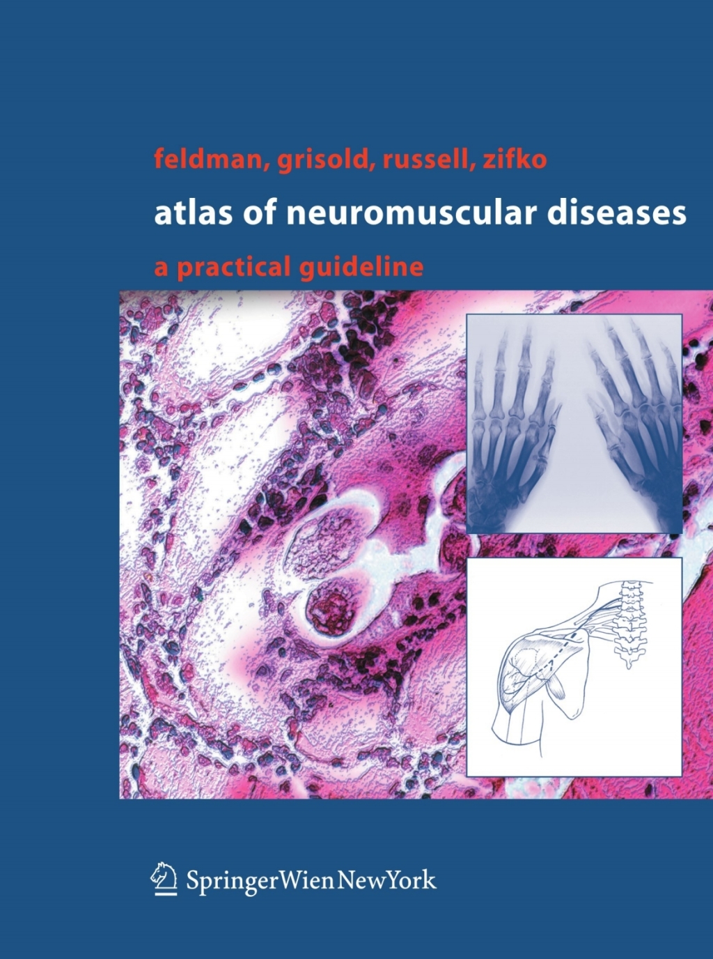 Atlas of Neuromuscular Diseases A Practical Guideline 
