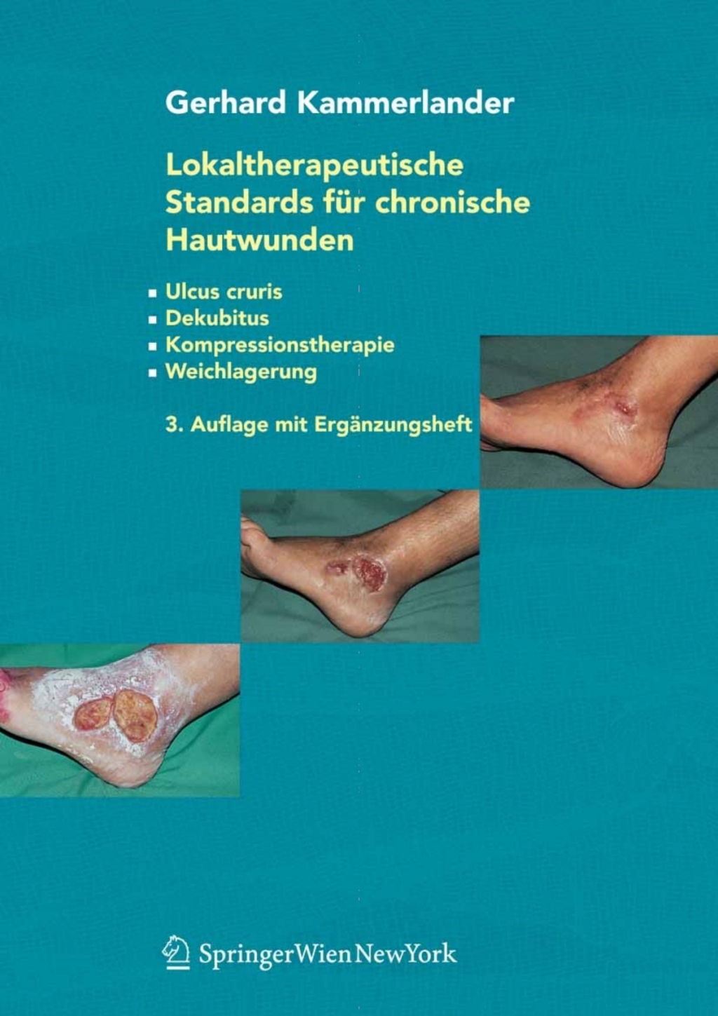 Lokaltherapeutische Standards fÃƒÂ¼r chronische Hautwunden Ulcus cruris - Dekubitus - Kompressionstherapie - Weichlagerung 3rd Edition