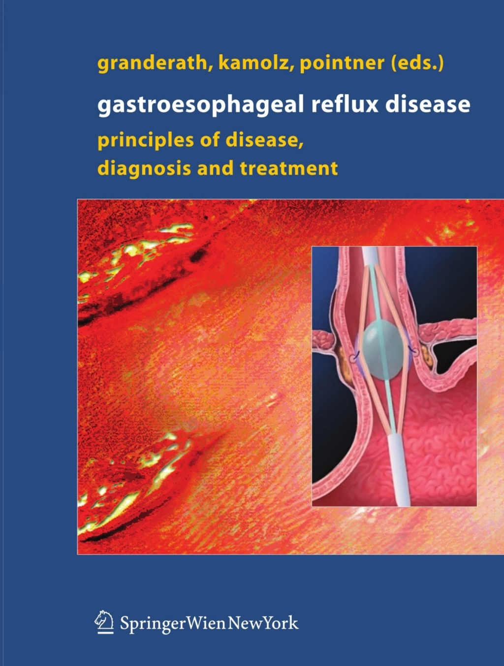 Gastroesophageal Reflux Disease Principles of Disease, Diagnosis, and Treatment 1st Edition