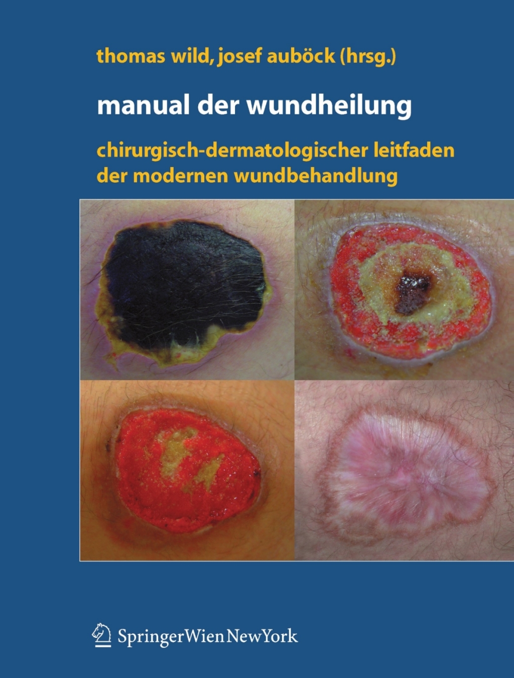 Manual der Wundheilung Chirurgisch-dermatologischer Leitfaden der modernen Wundbehandlung 1st Edition