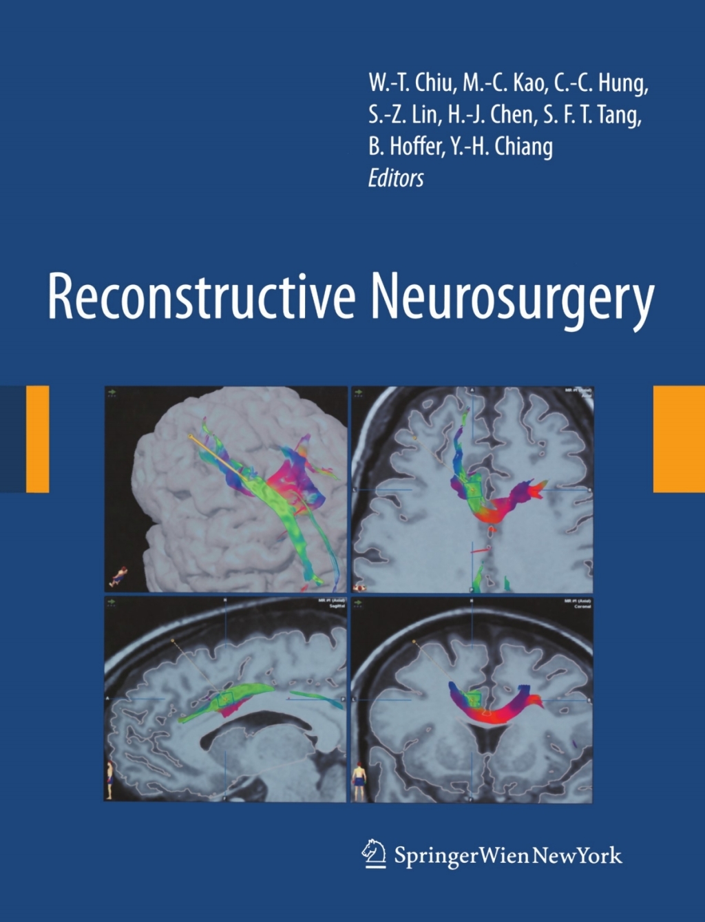 Reconstructive Neurosurgery 1st Edition