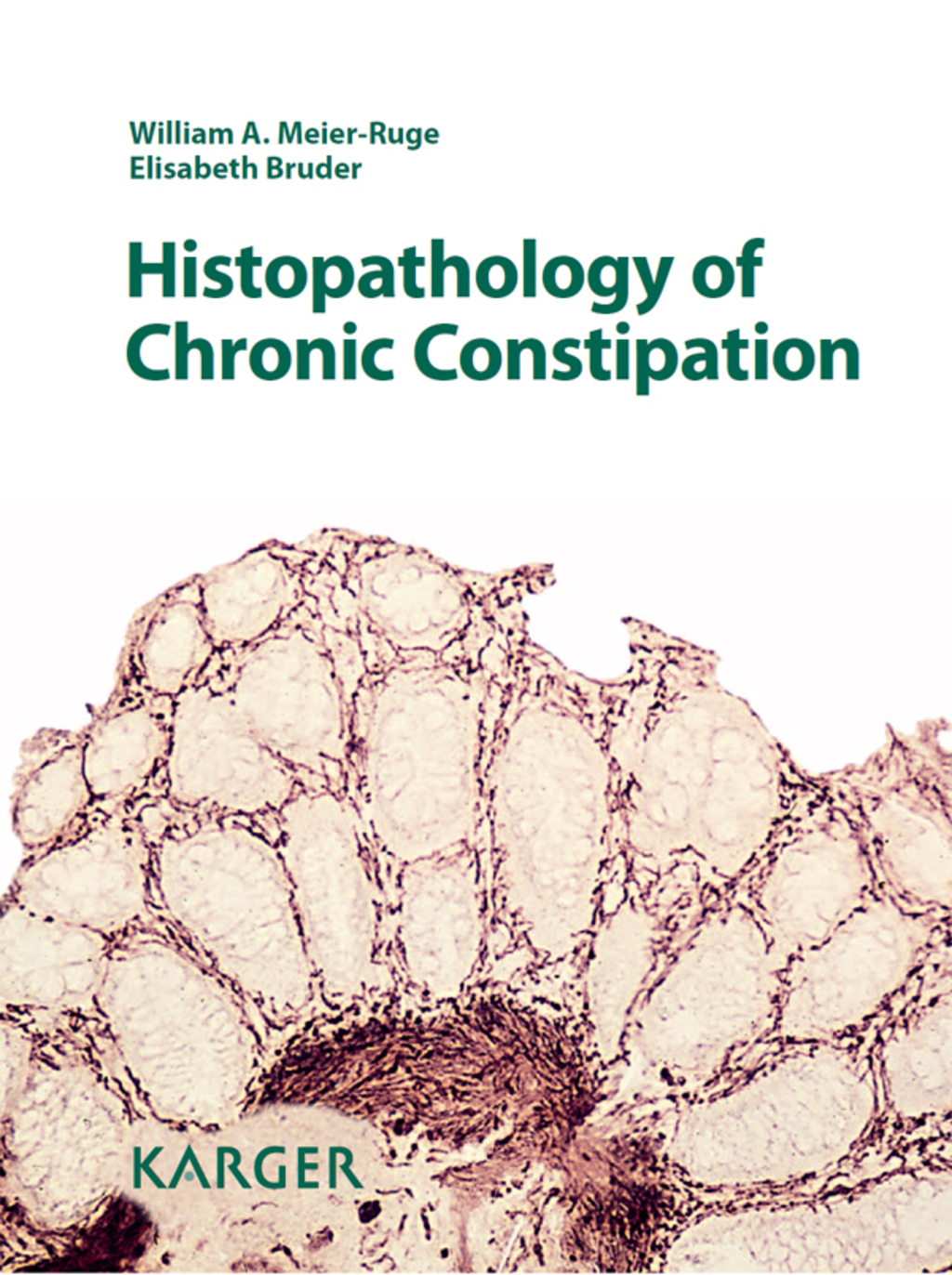 Histopathology of Chronic Constipation 2nd Edition