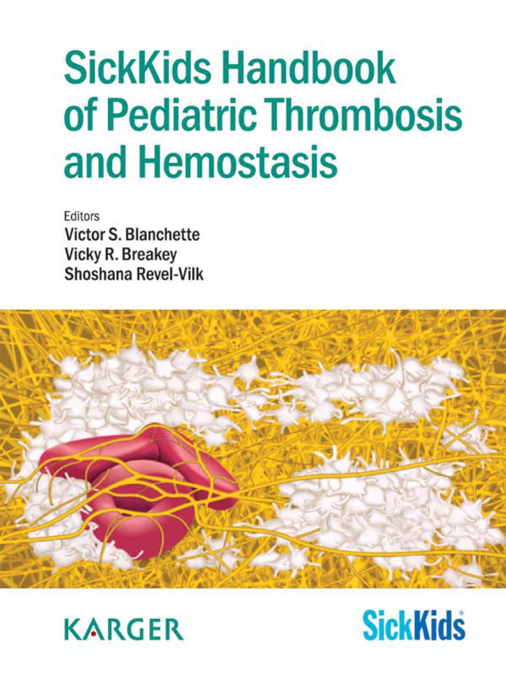 SickKids Handbook of Pediatric Thrombosis and Hemostasis 