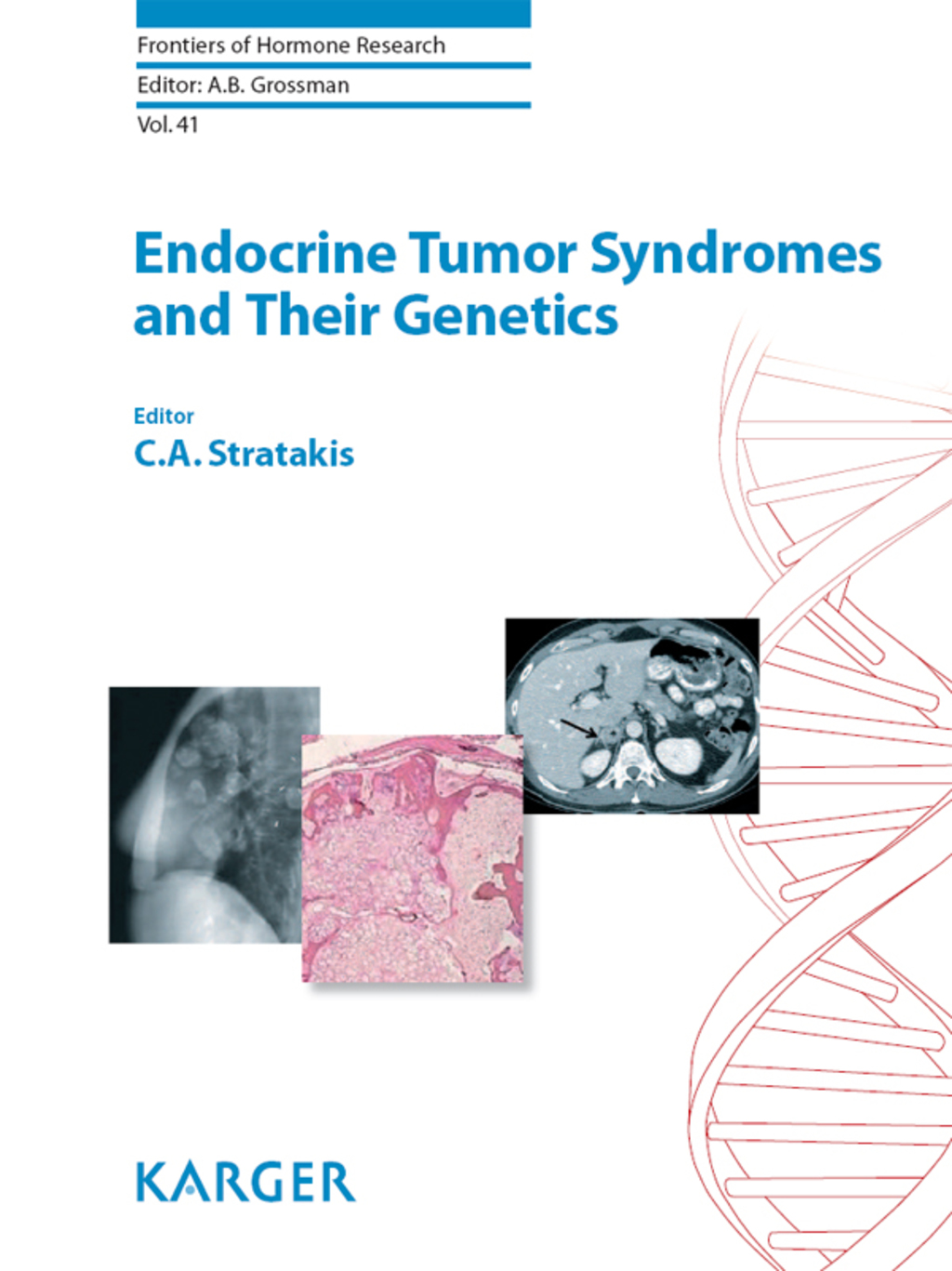 Endocrine Tumor Syndromes and Their Genetics 1st Edition
