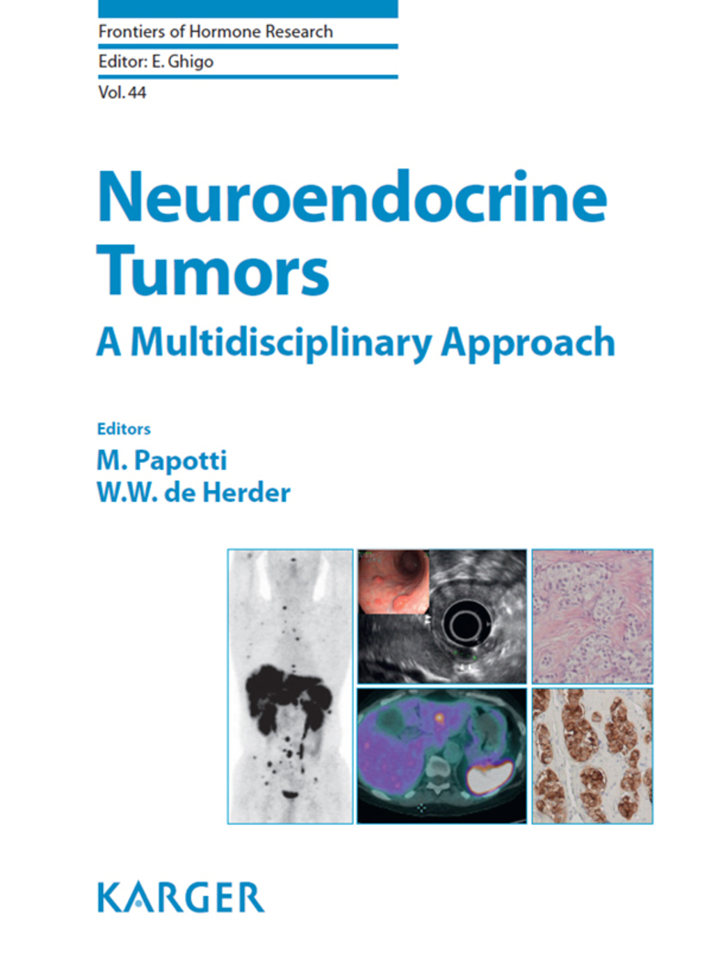 Neuroendocrine Tumors: A Multidisciplinary Approach 1st Edition