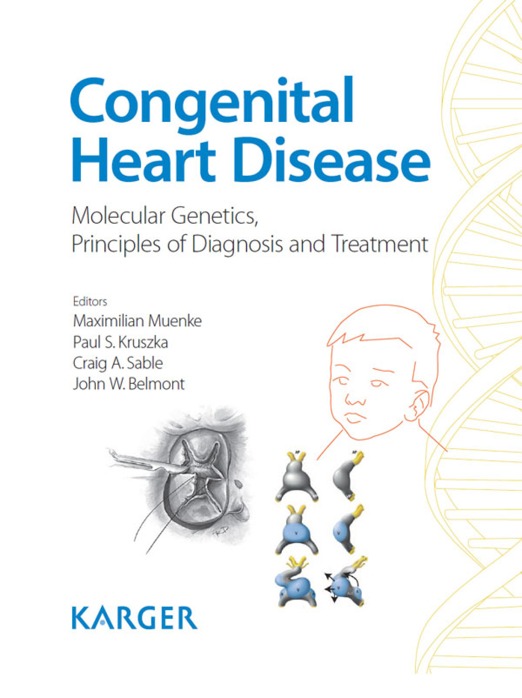 Congenital Heart Disease Molecular Genetics, Principles of Diagnosis and Treatment 1st Edition