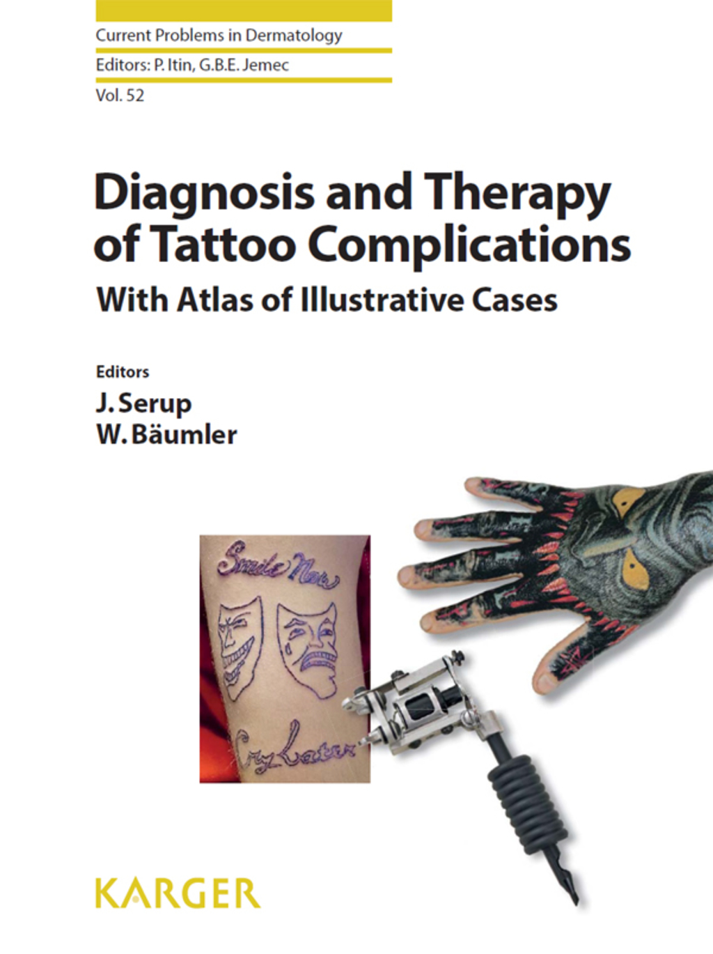 Diagnosis and Therapy of Tattoo Complications With Atlas of Illustrative Cases 1st Edition